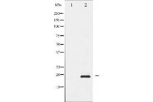 Western blot analysis of Survivin phosphorylation expression in A549 whole cell lysates,The lane on the left is treated with the antigen-specific peptide.