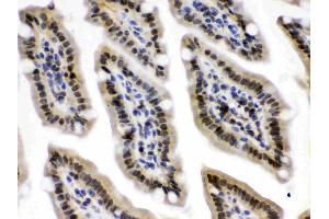 Immunohistochemistry (IHC) image for anti-Exportin 1 (XPO1) (AA 966-1071) antibody (ABIN4886771)