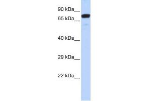 WB Suggested Anti-ZNF221 Antibody Titration:  0. (ZNF221 antibody  (N-Term))