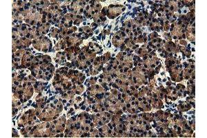 Immunohistochemical staining of paraffin-embedded Human Kidney tissue using anti-EPHX2 mouse monoclonal antibody.