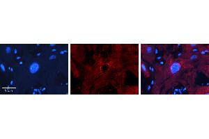 Rabbit Anti-MBD2 Antibody   Formalin Fixed Paraffin Embedded Tissue: Human heart Tissue Observed Staining: Nucleus Primary Antibody Concentration: 1:100 Other Working Concentrations: N/A Secondary Antibody: Donkey anti-Rabbit-Cy3 Secondary Antibody Concentration: 1:200 Magnification: 20X Exposure Time: 0.