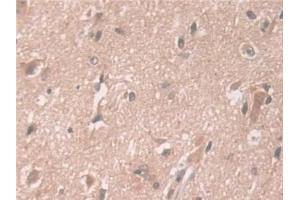 Immunohistochemistry (IHC) image for anti-ATPase, Cu++ Transporting, beta Polypeptide (ATP7B) (AA 59-426) antibody (ABIN7441340)