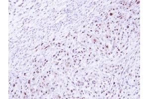 IHC-P Image Immunohistochemical analysis of paraffin-embedded SAS xenograft , using DRAK1, antibody at 1:500 dilution. (STK17A antibody)