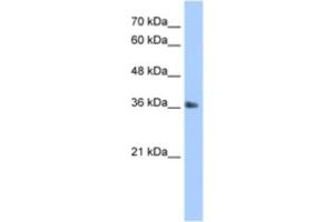 Western Blotting (WB) image for anti-TIMELESS Interacting Protein (TIPIN) antibody (ABIN2463351) (TIPIN antibody)