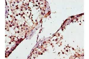 ATP8A2 antibody  (AA 358-570)