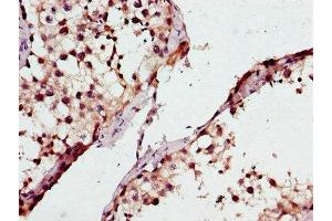 Immunohistochemistry of paraffin-embedded human testis tissue using ABIN7163370 at dilution of 1:100 (ATP8A2 antibody  (AA 358-570))