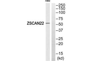 Western blot analysis of extracts from K562 cells, using ZSCAN22 antibody. (ZSCAN22 antibody  (Internal Region))