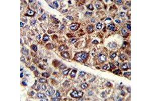 Immunohistochemistry (IHC) image for anti-CD38 (AA 241-270) antibody (ABIN3028550)