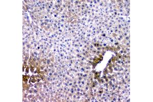 IHC analysis of RMI2 using anti-RMI2 antibody (ABIN6719656).