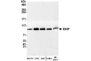 Western Blotting (WB) image for anti-Ubiquitin Protein Ligase E3A (ube3a) (AA 400-450) antibody (ABIN7449675) (ube3a antibody  (AA 400-450))