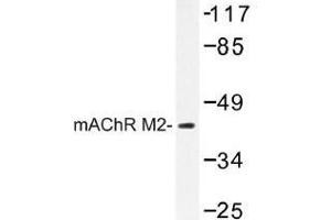 Image no. 1 for anti-Cholinergic Receptor, Muscarinic 2 (CHRM2) antibody (ABIN317739) (Muscarinic Acetylcholine Receptor M2 antibody)