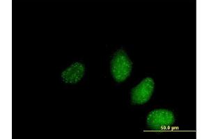 Immunofluorescence of  purified  MaxPab antibody to NS4ATP2 on HeLa cell. (SAP30L antibody  (AA 1-183))