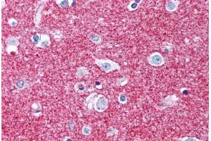 Human Brain, Putamen, Neuropil (formalin-fixed, paraffin-embedded) stained with GAP43 antibody ABIN305762 at 5 ug/ml followed by biotinylated anti-mouse IgG secondary antibody ABIN481714, alkaline phosphatase-streptavidin and chromogen. (GAP43 antibody)