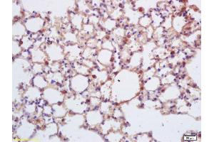 Formalin-fixed and paraffin embedded mouse lung labeled with Anti-Insulin receptor subunit beta/INSR/CD220 Polyclonal Antibody, Unconjugated (ABIN1714205) at 1:200 followed by conjugation to the secondary antibody and DAB staining. (ISR-beta antibody  (AA 801-900))