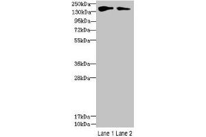 Western blot All lanes: FYCO1 antibody at 2.