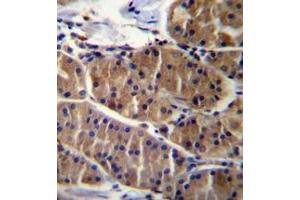 Immunohistochemistry analysis in formalin fixed and paraffin embedded human stomach tissue reacted with LRSAM1 Antibody (N-term) followed which was peroxidase conjugated to the secondary antibody and   followed by DAB staining. (LRSAM1 antibody  (N-Term))