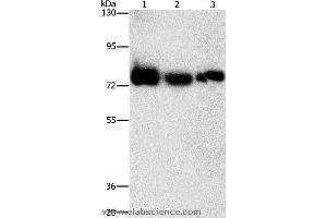 Western blot analysis of Human fetal muscle tissue, K562 and hela cell, using AMPD1 Polyclonal Antibody at dilution of 1:1600