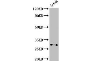 Western Blot Positive WB detected in: Mouse lung tissue All lanes: SPINT2 antibody at 3 μg/mL Secondary Goat polyclonal to rabbit IgG at 1/50000 dilution Predicted band size: 29, 22 kDa Observed band size: 29 kDa (SPINT2 antibody  (AA 71-194))