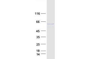 Validation with Western Blot (P4HA1 Protein (Transcript Variant 1) (Myc-DYKDDDDK Tag))