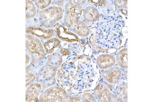 Immunohistochemistry of paraffin-embedded rat kidney using GCN2 Rabbit pAb (ABIN6127829, ABIN6140031, ABIN6140033 and ABIN6216318) at dilution of 1:250 (40x lens). (GCN2 antibody  (AA 1-300))
