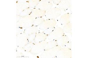 Immunohistochemistry of paraffin embedded mouse Skeletal muscle using RB1 (ABIN7075477) at dilution of 1:1400 (400x lens)