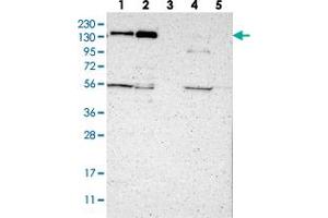 Western blot analysis of Lane 1: RT-4, Lane 2: U-251 MG, Lane 3: Human Plasma, Lane 4: Liver, Lane 5: Tonsil with JMJD2A polyclonal antibody  at 1:250-1:500 dilution. (KDM4A antibody)