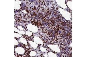Immunohistochemical staining of human bone marrow with C19orf48 polyclonal antibody  shows strong cytoplasmic positivity in hematopoietic cells.