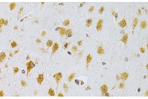 Immunohistochemistry of paraffin-embedded Mouse brain using MDM2 Polyclonal Antibody at dilution of 1:200 (40x lens). (MDM2 antibody)
