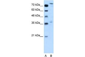 WB Suggested Anti-NFE2L3 Antibody Titration:  0.