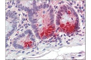 Small intestine, Human: Formalin-Fixed, Paraffin-Embedded (FFPE) (SRD5A1 antibody)