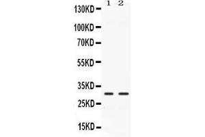 Western blot analysis of CA3 expression in rat cardiac muscle extract ( Lane 1) and mouse cardiac muscle extract ( Lane 2). (CA3 antibody  (AA 14-235))