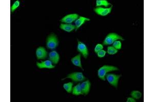 Immunofluorescence staining of Hela cells with ABIN7152141 at 1:100, counter-stained with DAPI. (PERK antibody  (AA 115-330))