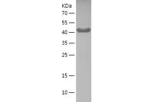 Western Blotting (WB) image for Autophagy Related 13 (ATG13) (AA 297-517) protein (His-IF2DI Tag) (ABIN7283958) (ATG13 Protein (AA 297-517) (His-IF2DI Tag))