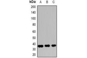 Western blot analysis of Caspase 1 expression in HEK293T (A), Hela (B), MCF7 (C) whole cell lysates. (Caspase 1 antibody  (C-Term))