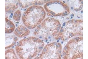 Used in DAB staining on fromalin fixed paraffin- embedded Kidney tissue (IL-4 antibody  (AA 25-153))
