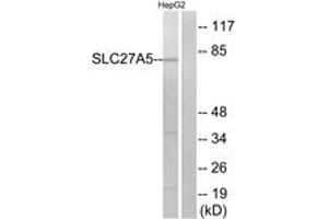 Western blot analysis of extracts from HepG2 cells, using SLC27A5 Antibody. (SLC27A5 antibody  (AA 481-530))