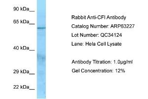 Western Blotting (WB) image for anti-Complement Factor I (CFI) (N-Term) antibody (ABIN970385) (Complement Factor I antibody  (N-Term))