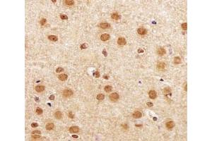 IHC analysis of FFPE mouse brain section using SIRT1 antibody at 1:25. (SIRT1 antibody  (AA 566-601))