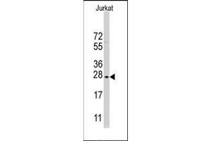 Western blot analysis of CLDN1 Antibody (Loop1) in Jurkat cell line lysates (35ug/lane). (Claudin 1 antibody  (Loop 1))