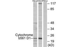 Image no. 1 for anti-Cytochrome B-561 Domain Containing 1 (CYB561D1) (AA 180-229) antibody (ABIN2889869) (CYB561D1 antibody  (AA 180-229))