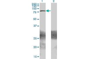 Western Blot analysis of ZBTB33 expression in transfected 293T cell line by ZBTB33 monoclonal antibody (M01A), clone 2B2. (ZBTB33 antibody  (AA 564-673))