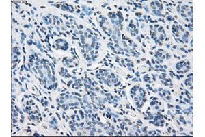 Immunohistochemical staining of paraffin-embedded breast tissue using anti-PSMA7 mouse monoclonal antibody.