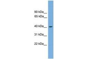 Image no. 1 for anti-Acetyl-CoA Acetyltransferase 1 (ACAT1) (AA 143-192) antibody (ABIN6745050) (ACAT1 antibody  (AA 143-192))