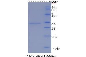 SDS-PAGE (SDS) image for Hepatitis A Virus Cellular Receptor 1 (HAVCR1) (AA 22-237) protein (His tag) (ABIN1080177)