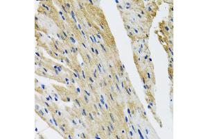 Immunohistochemistry of paraffin-embedded mouse heart using COPB2 antibody (ABIN5974232) at dilution of 1/100 (40x lens). (COPB2 antibody)