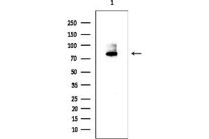 anti-Interleukin-1 Receptor-Associated Kinase 1 (IRAK1) (Internal Region) antibody