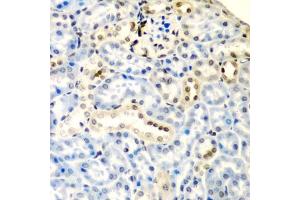 Immunohistochemistry of paraffin-embedded mouse kidney using DCTD antibody  at dilution of 1:200 (40x lens).