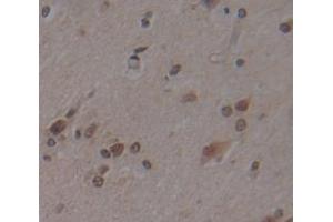 IHC-P analysis of Human Tissue, with DAB staining. (JNK antibody  (AA 145-419))