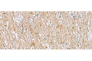 Immunohistochemistry of paraffin-embedded Human brain tissue using LRRC49 Polyclonal Antibody at dilution of 1:40(x200) (LRRC49 antibody)