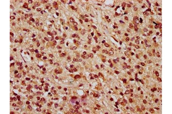 PARP3 antibody  (AA 1-240)